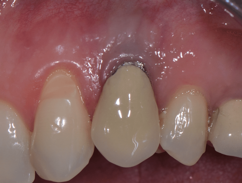 lefloch-dent-gencive-maladie